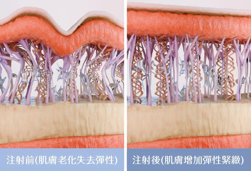 曼陀皇家系列純淨美感