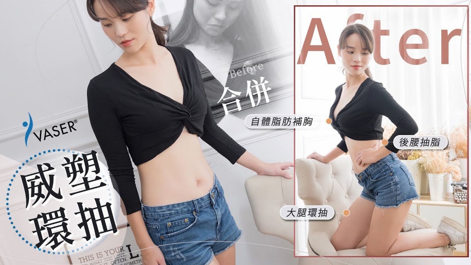 抽脂手術 | Nancy展現窈窕身姿Vaser2.2威塑大腿環抽後腰抽脂&自體脂肪隆乳 台北抽脂 亞緻整形TaipeiArts