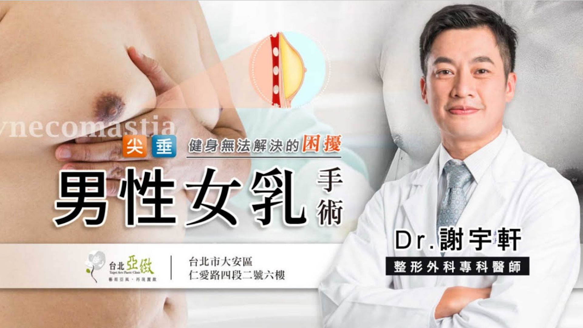 男性女乳症乳房凸起困擾 男性女乳手術重建體態 台北亞緻TaipeiArts謝宇軒醫師